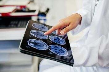 Doctor pointing to brain scan images